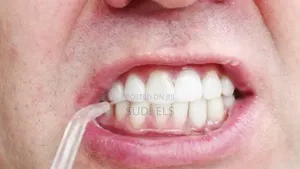Oral Irrator