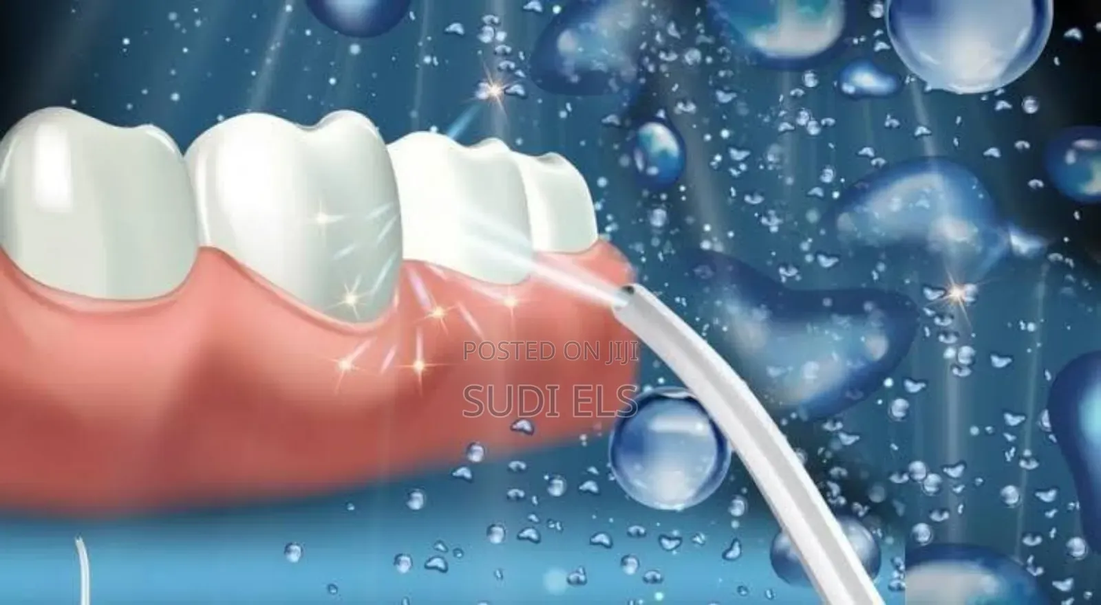 Oral Irrator
