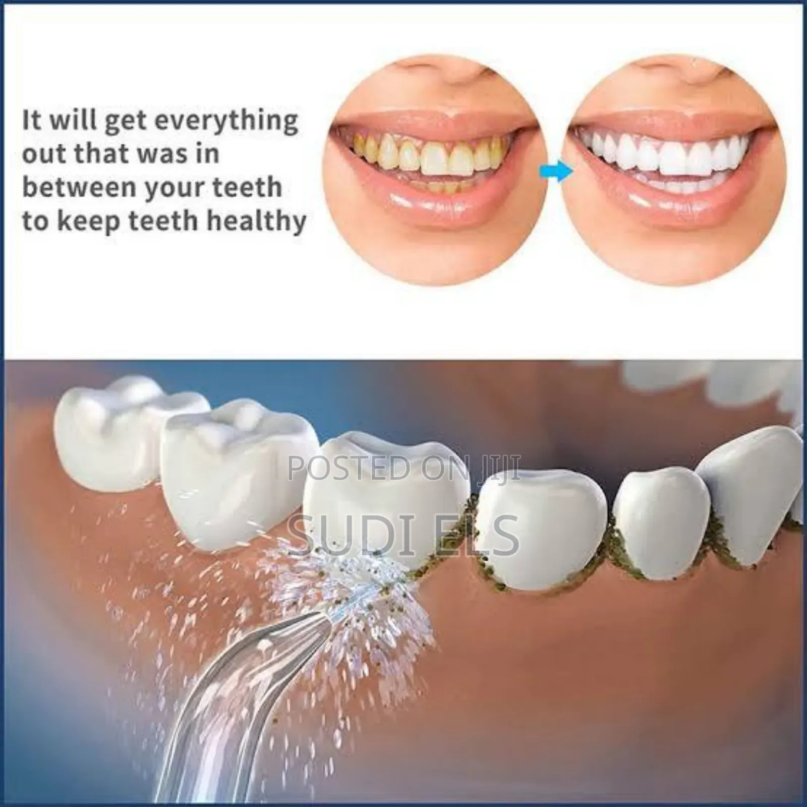 Oral Irrator