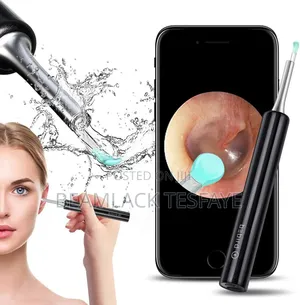 Xiaomi Original Bebird R1 Visual Ear Wax Cleaner