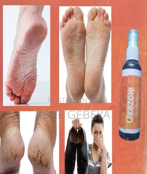 Oxzole Anti Fungal