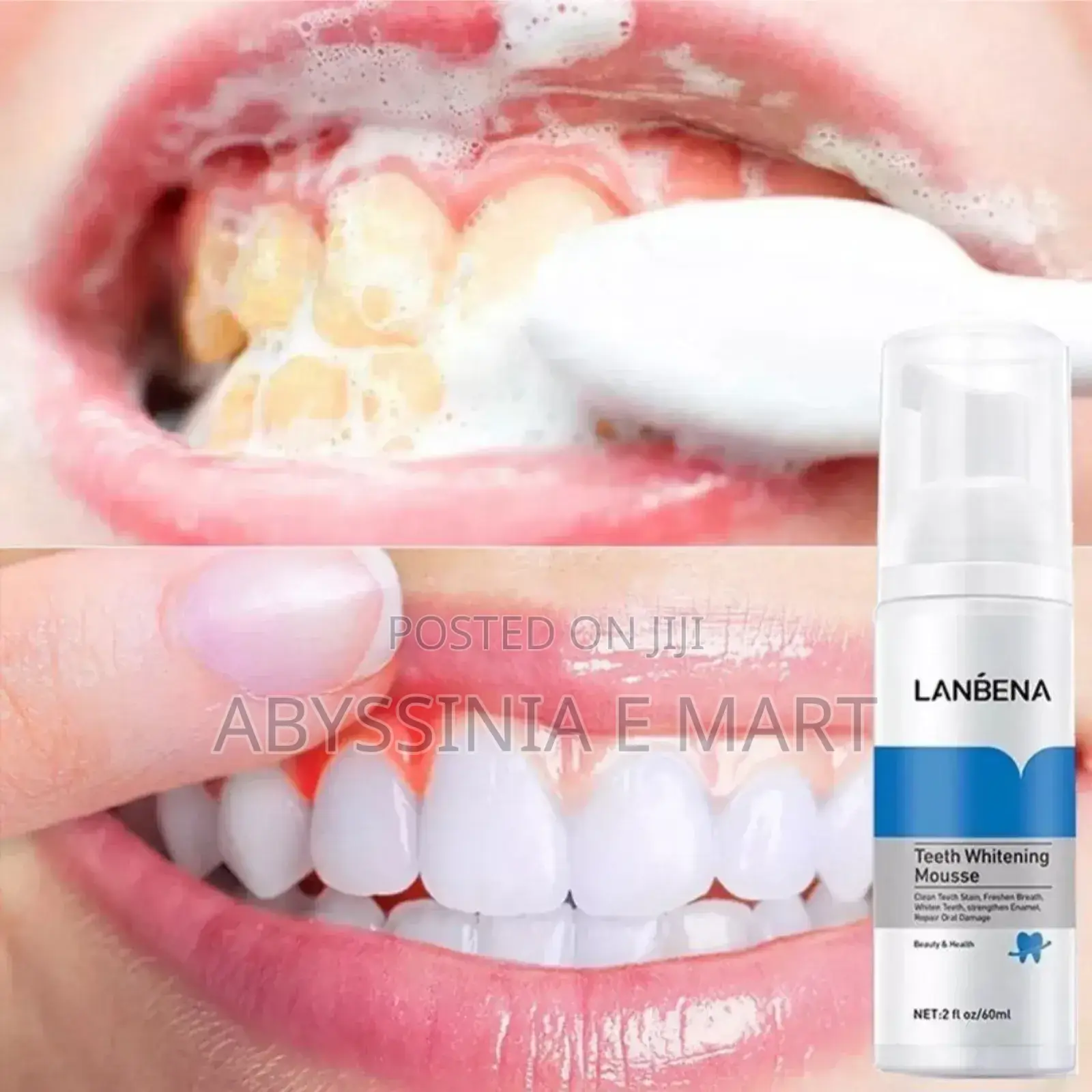 Lanbena Teeth Whitening