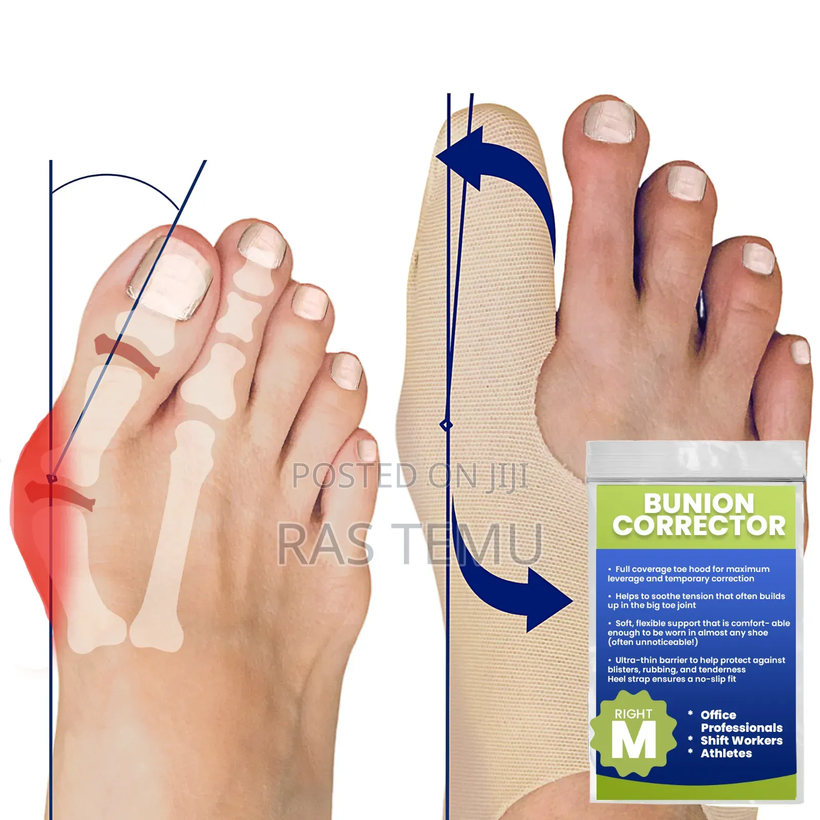 Bunion Corrector