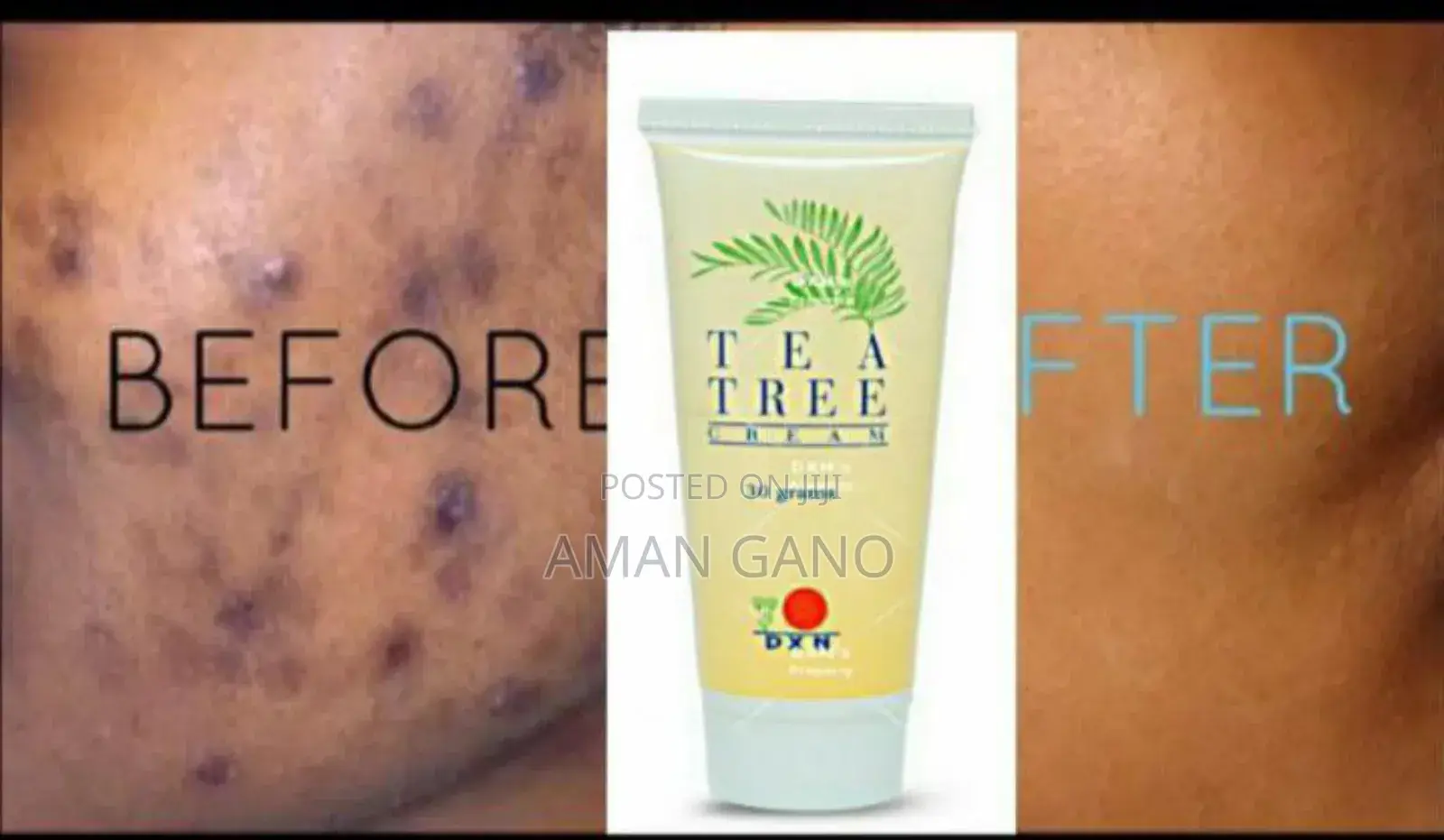 DXN Teatree Cream