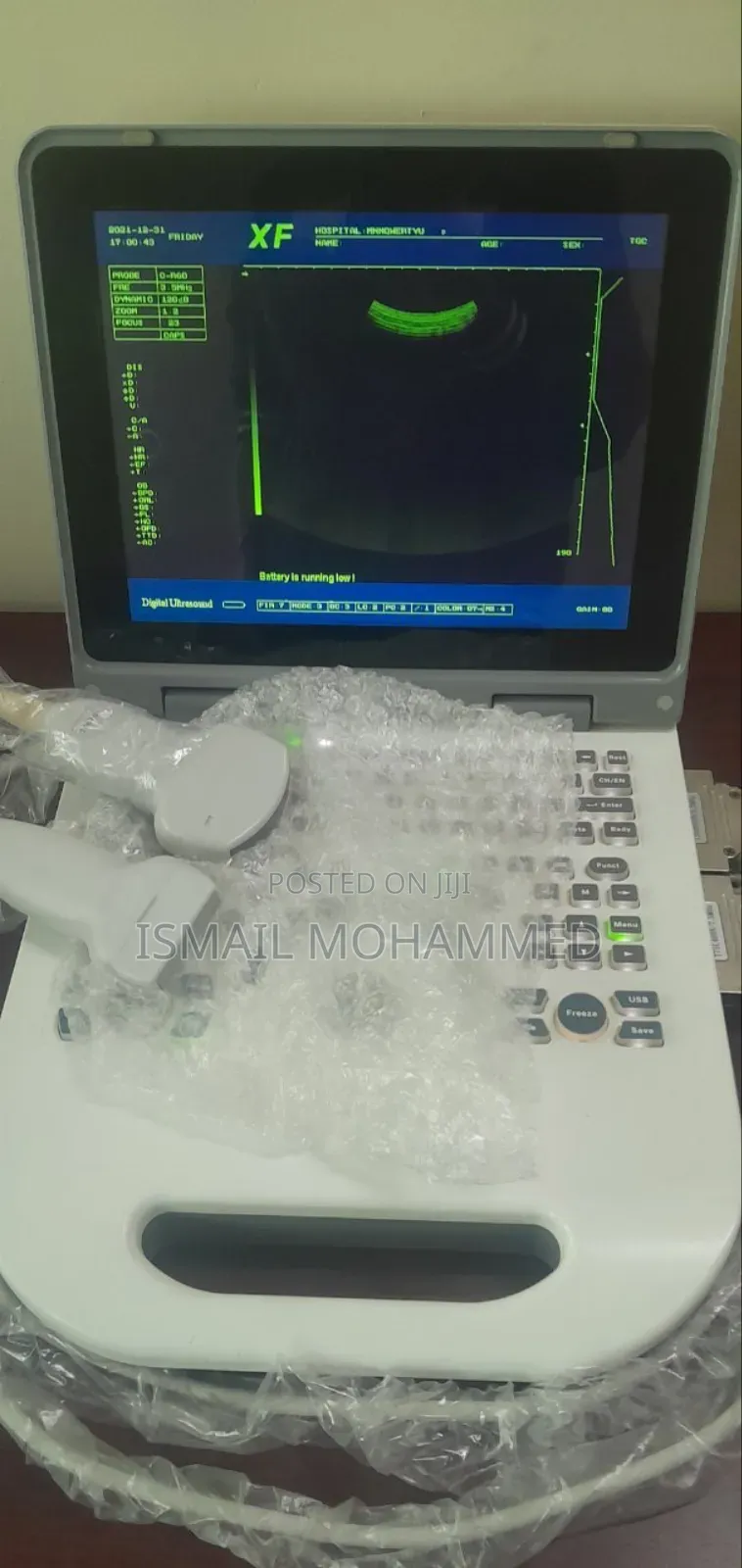 Xf Pro50 Ultrasound