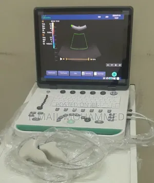 Sonostar Color Doppler Ultrasound