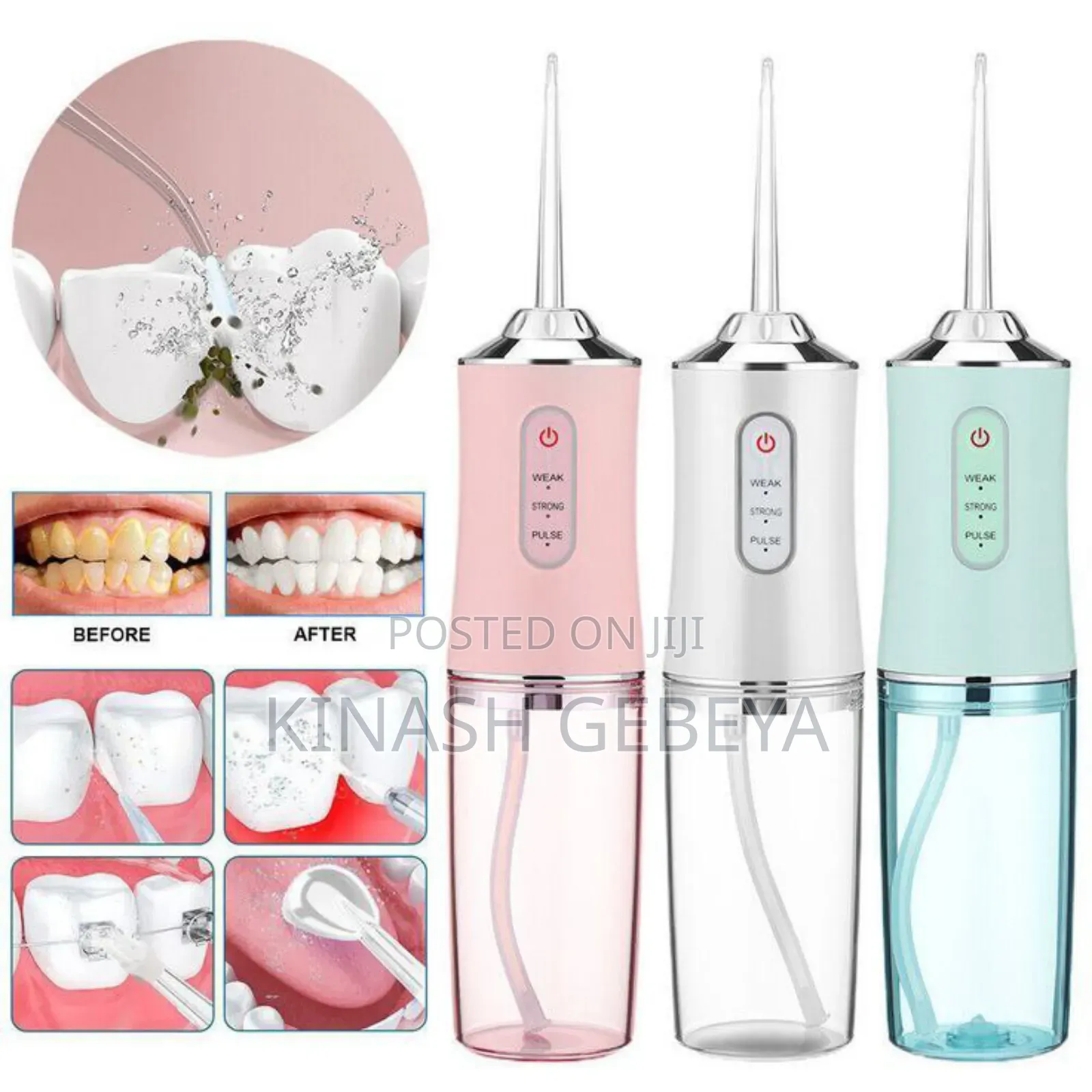 4in1 Portable Dental Water Flosser