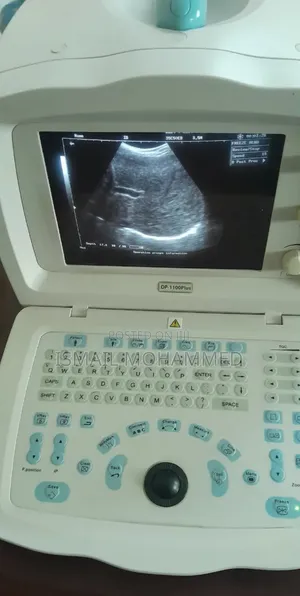 Mindray Dp-1100 Plus Ultrasound