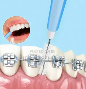 Interdental Brush for Braces