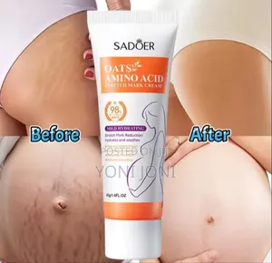 Streach Mark Removal