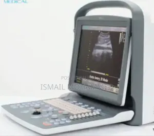 Chison Echo 2 Ultrasound Machine