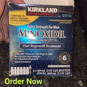 Healing *#HairKirkland Minixidil